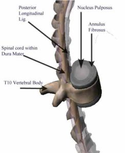 Shows Nucleus and Annulus of an Inter-vertebral Disc